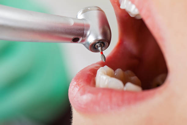 Best Urgent Dental Care  in Matamoras, OH
